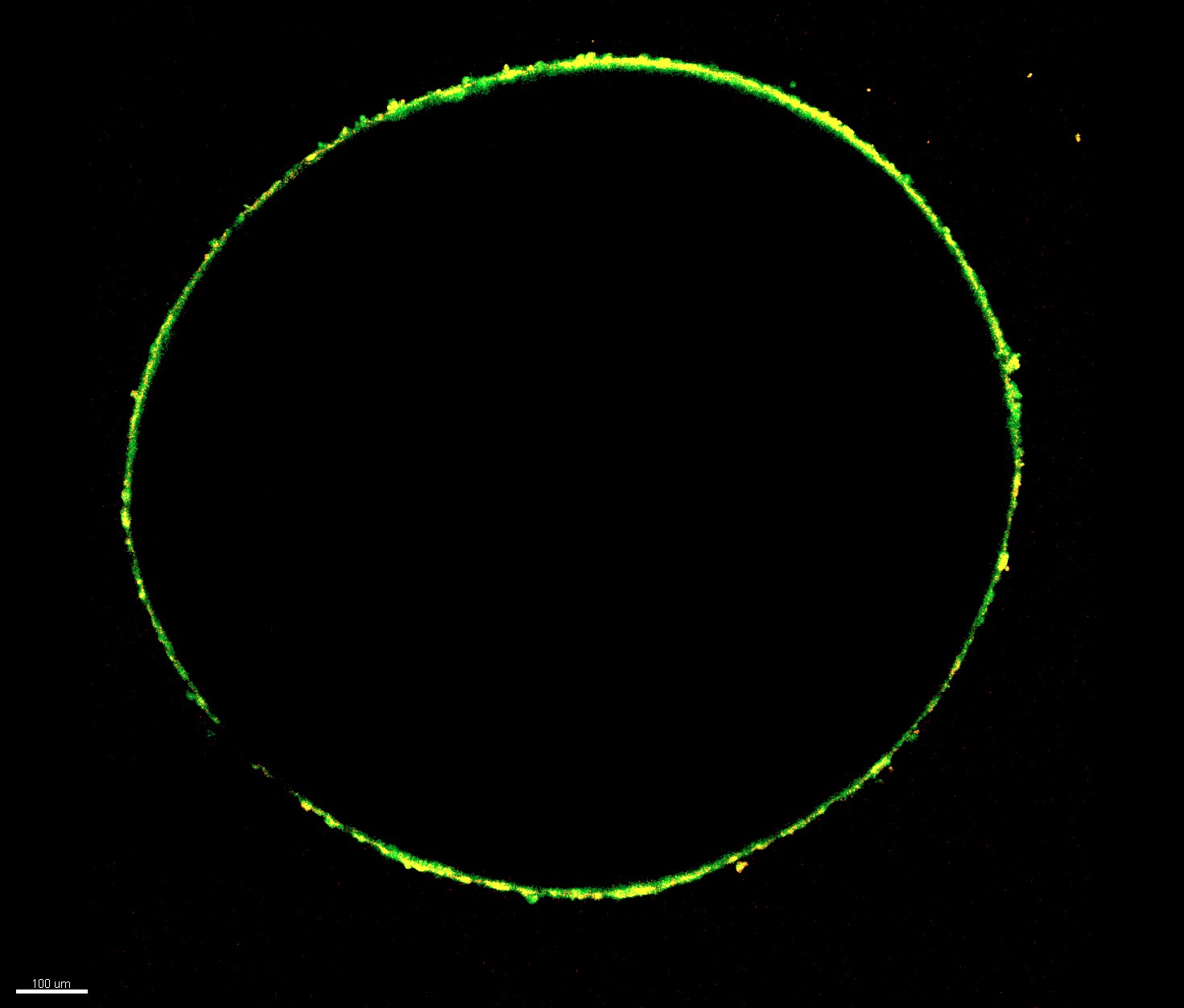 optic tectum